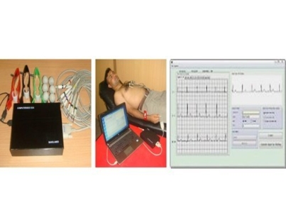12 Channel BiBeat PC Based ECG Machine